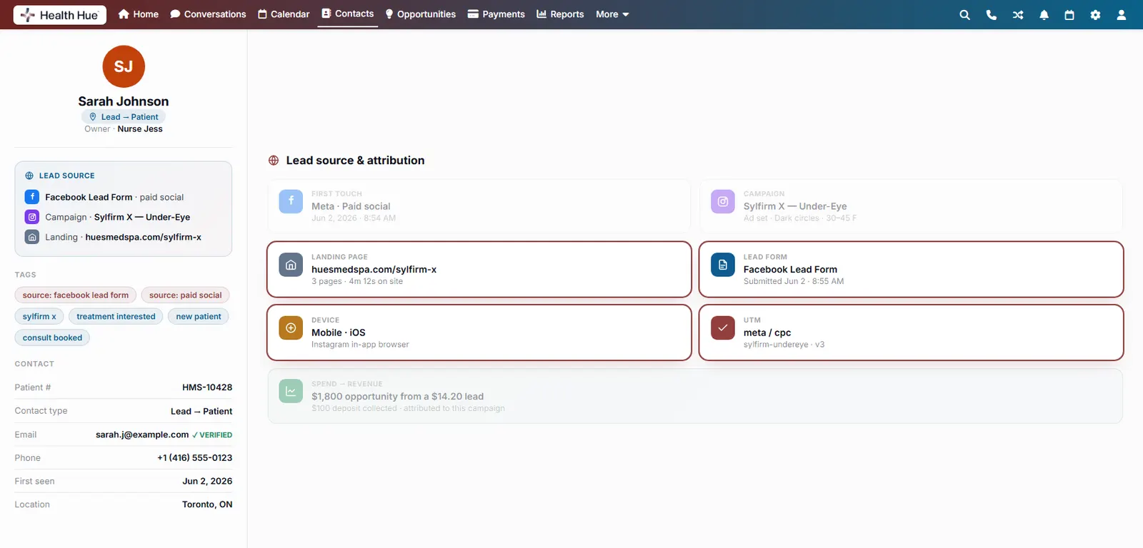 The lead-source panel with the landing page, lead form, device, and UTM cards highlighted.