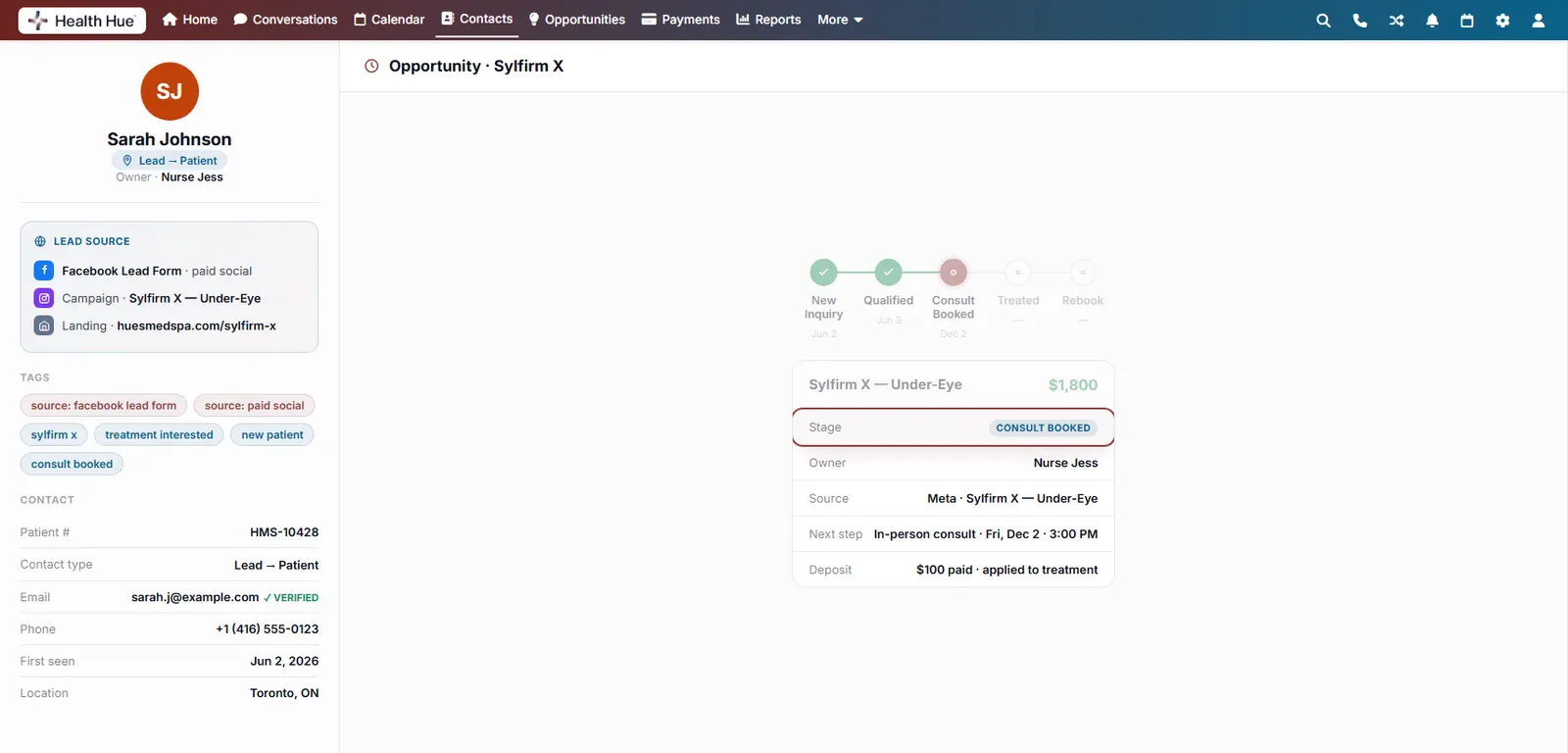 The opportunity view with the current stage highlighted, automatically updated to consult booked.