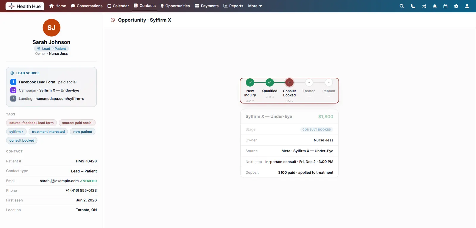 The opportunity view with the pipeline stage tracker highlighted, from new inquiry through qualified to consult booked.