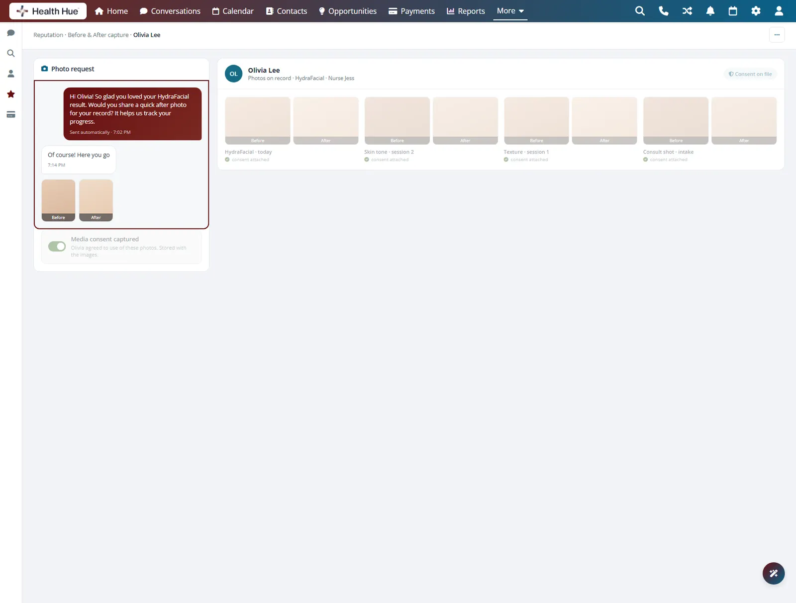 A before-and-after photo request in the Health Hue Hub, sent automatically and returning the patient photos.