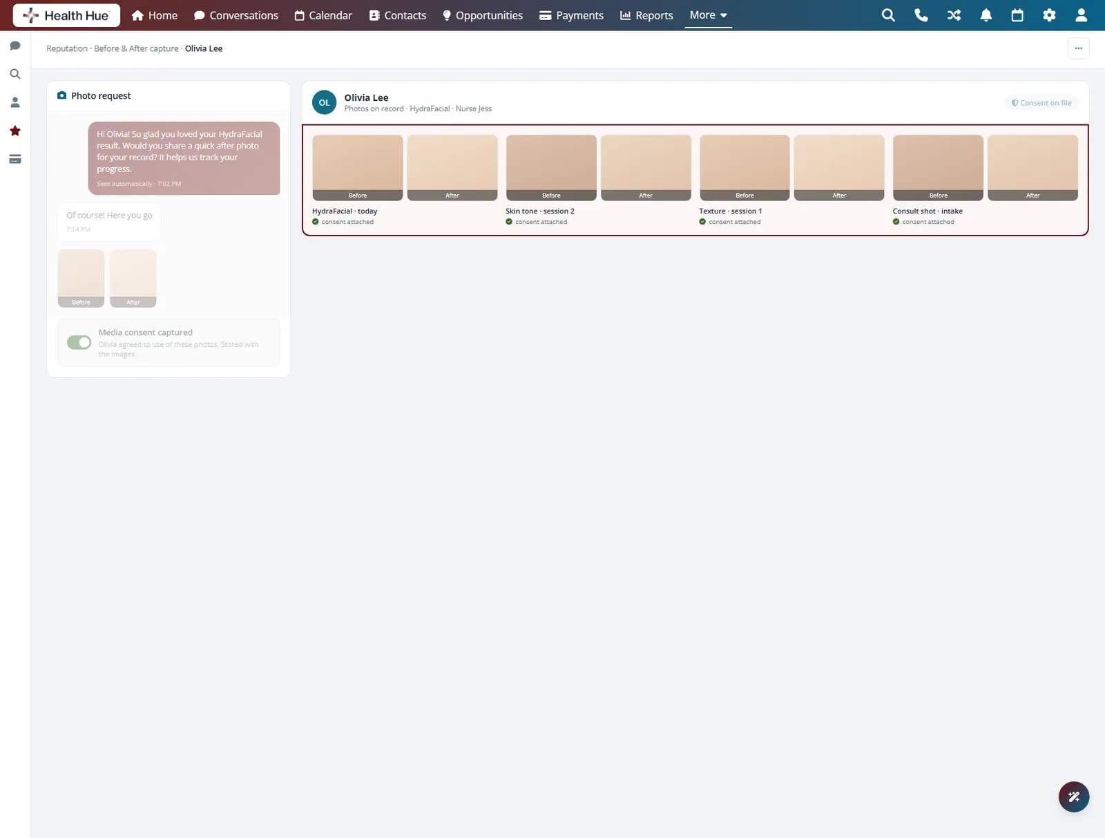 The same record showing the before-and-after photos saved to the patient profile beside the treatment.